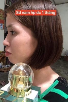 Sau khi loại bỏ nám nhìn trẻ ra chục tuổi Sau khi loại bỏ nám nhìn trẻ ra chục tuổi