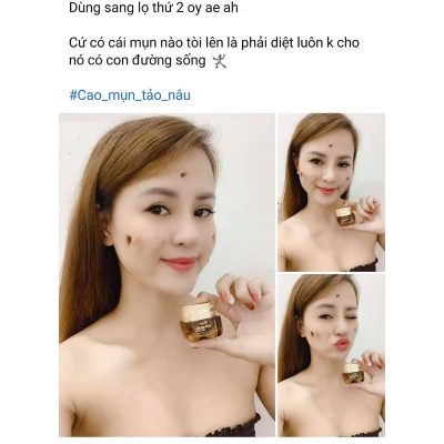 Da không những sạch mụn mà còn sáng đẹp Da không những sạch mụn mà còn sáng đẹp