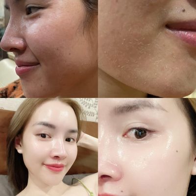 Da đẹp như được tái sinh Da đẹp như được tái sinh