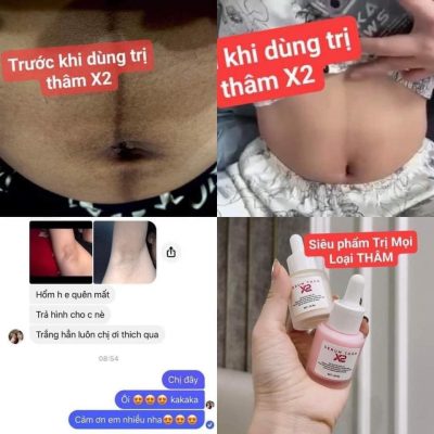 Khách hàng dùng cho khử thâm vùng bụng, nách Khách hàng dùng cho khử thâm vùng bụng, nách