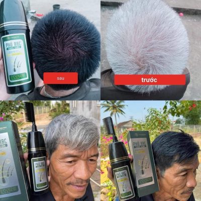 Tóc bạc thành tóc đen chỉ sau thời gian ngắn Tóc bạc thành tóc đen chỉ sau thời gian ngắn